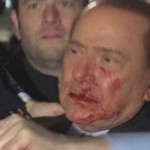Silvio Berlusconi aggredito da Massimo Tartaglia Silvio Berlusconi aggredito da Massimo Tartaglia